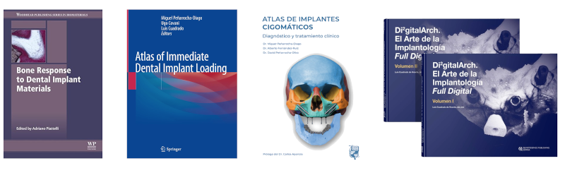 Cubiertas de los libros académicos en los que el Dr. David Soto Peñaloza aparece como coautor: Bone Response to Dental Implant Materials, Atlas of Immediate Dental Implant Loading, Atlas de Implantes Cigomáticos y Di³italArch El Arte de la Implantología Full Digital volúmenes I y II.