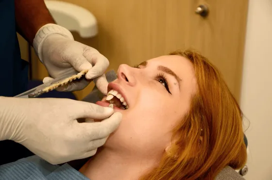 María, 25 años, sonrisa tras carillas de porcelana en Clinic Art Alboraya