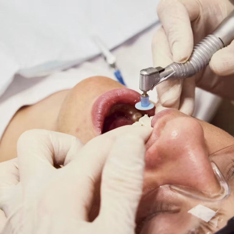 cirugia oral