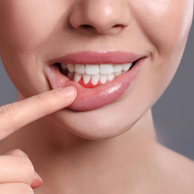 periodoncia